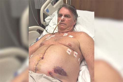 Bolsonaro completa uma semana internado e divulga imagem do pós-operatório