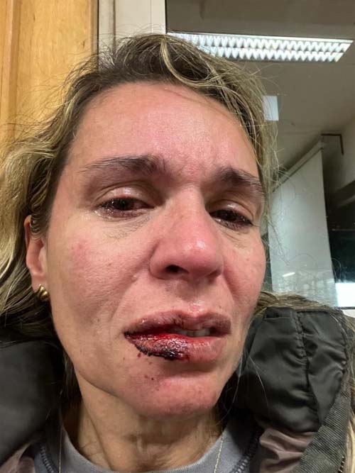 A real de Portugal: deputados questionam ministra sobre agressão a brasileira em universidade