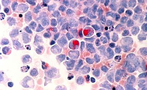 Novo diretor do Inca promete aumentar controle precoce do câncer