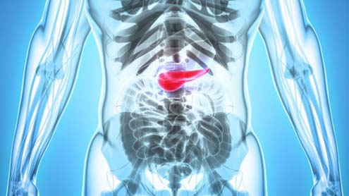 Os sintomas de câncer de pâncreas que muitas vezes passam despercebidos