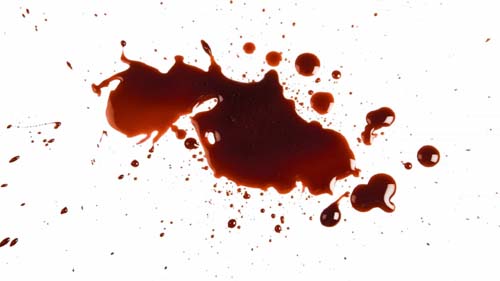 Cancêr no intestino? O que fazer?