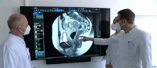 Por que as mortes por câncer de intestino estão diminuindo