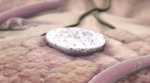 Vacina contra o câncer de mama mais agressivo tem sucesso em teste com camundongos, aponta pesquisa