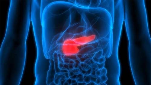 Por que câncer de pâncreas entrou para a lista dos que mais matam no Brasil