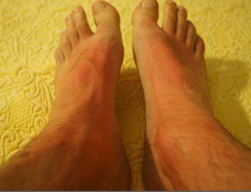 Homens sentem na pele o dano da negligência à saúde