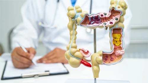 Vegetais Crucíferos Podem Diminuir em 20% o Risco de Câncer Intestinal, Indica Pesquisa Recente