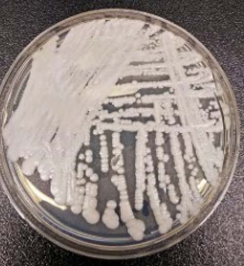 'Superfungo' resistente a medicação se espalha rapidamente pelo mundo