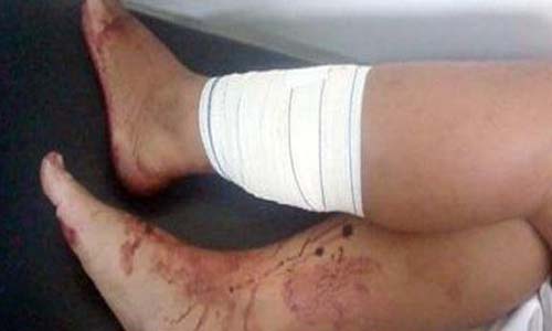 Bloco de carnaval de São Miguel dos Campos termina com três foliões baleados 