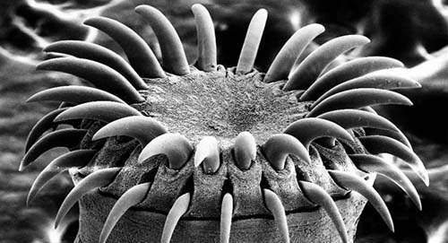 Carne suína provoca surgimento de mais de 700 solitárias no cérebro e pulmões de chinês