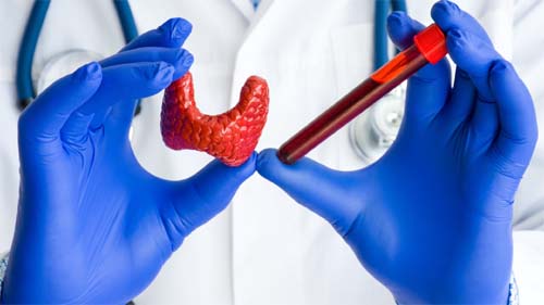 Pessoas com hipotiroidismo podem manifestar sintoma estranho na pele