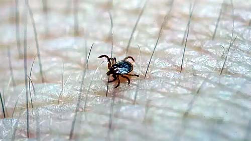 Os 5 fatores que explicam alta mortalidade da febre maculosa