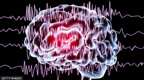Polarização política: como os cérebros de liberais e conservadores processam a mesma informação de modo diferente