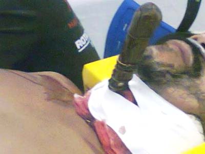 Desempregado é resgatado com faca enfiada na garganta