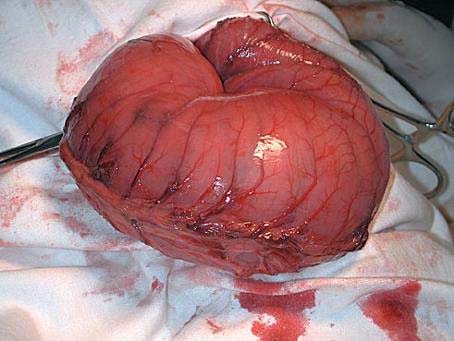 Pacientes fazem fila no HU de Alagoas