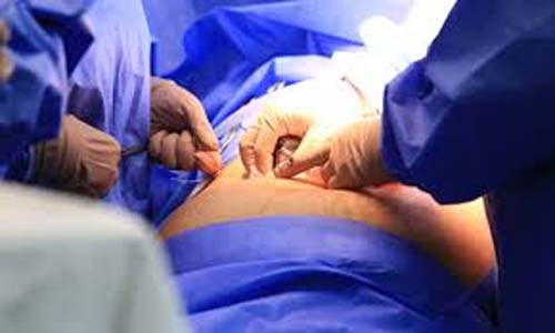 Fila por cirurgia no SUS ultrapassa 1,3 milhão de pessoas e cresce 26% em um ano
