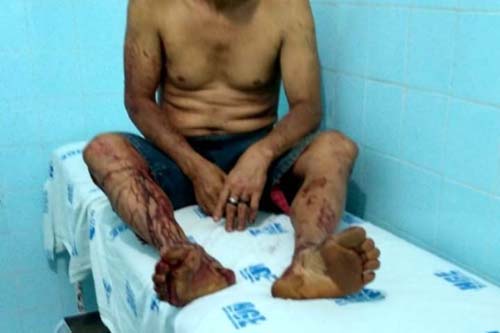 Em Colônia bandidos invadem casa e atiram contra 4 pessoas; dois morreram e dois ficaram feridos 