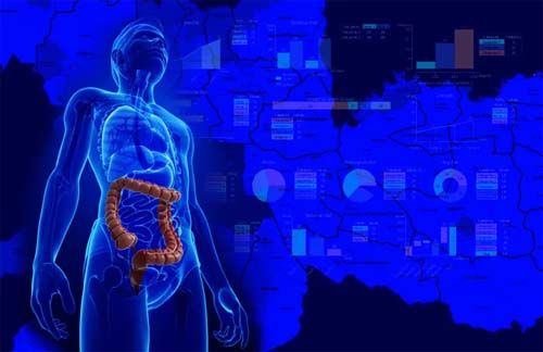 Prevenção é a principal aliada no combate ao câncer de intestino 