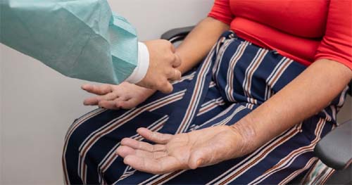 Profissionais da Saúde em capacitação intensiva para combate e controle da hanseníase em Maceió