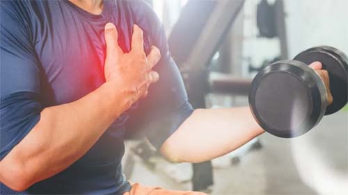 Verão: os impactos dos anabolizantes e treinos intensos no coração masculino