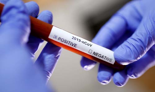 Ministério da Saúde negocia com Butantan ampliação para 100 milhões de doses da CoronaVac