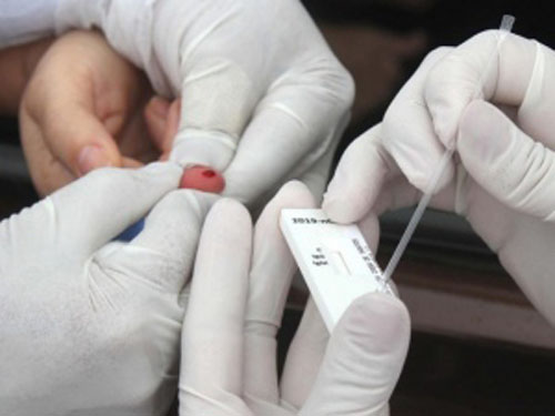 AL registra mais 21 mortes e se aproxima dos 20 mil casos confirmados de Covid