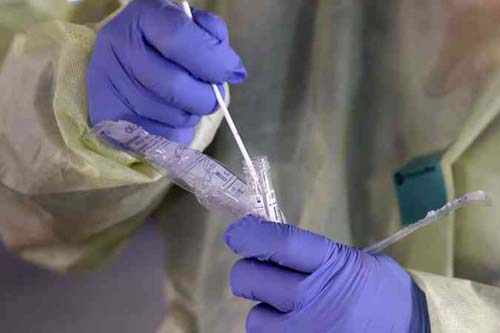 Brasil termina março com 201 mortes e 5.717 casos confirmados de covid-19