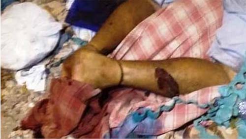 Perícia identifica corpo encontrado por trás de cemitério em Maceió