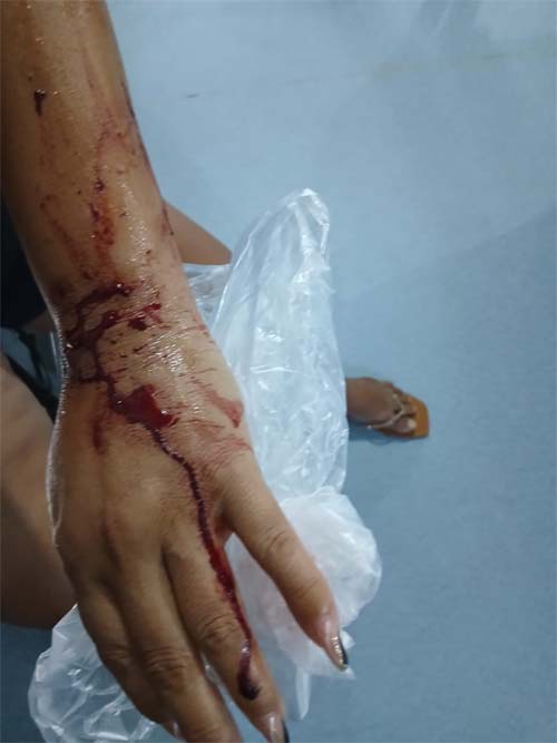 Paciente em crise de depressão sangra por mais de 40 minutos enquanto é negligenciada na Unidade de Saúde de Jaraguá