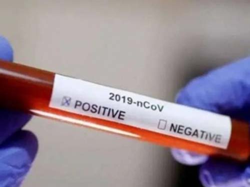 Mais de 50% das vítimas que morreram por Covid em Maceió eram pardas e negras