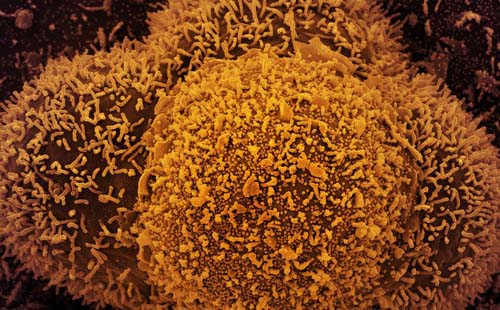 Alagoas registra 56 novos casos de Covid-19 e mais três mortes neste sábado (26)