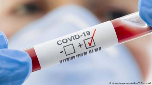 Covid-19: nove óbitos são confirmados pela Sesau nas últimas 24h