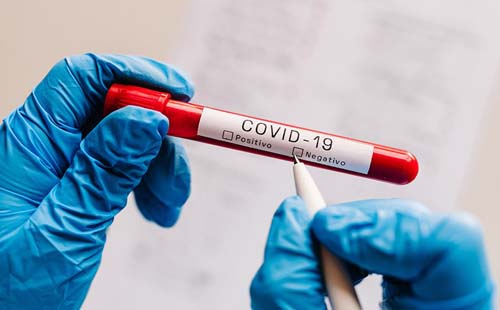 Pandemia dá sinais de controle em Alagoas, segundo Observatório da Ufal