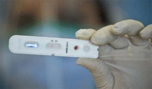 País tem média móvel diária de 784 mortes por covid, a menor dos últimos 112 dias