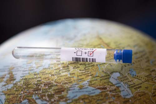 Coronavírus: quase 900 voluntários começam a receber vacina chinesa em SP