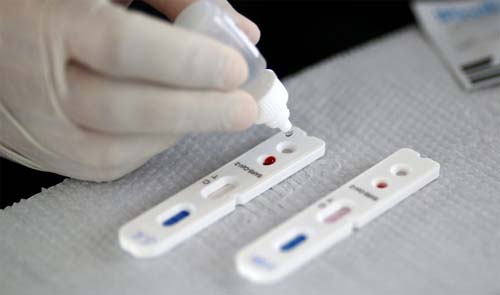 MPC/AL pede explicações a prefeito de Tanque D’Arca sobre compra de testes para Covid-19