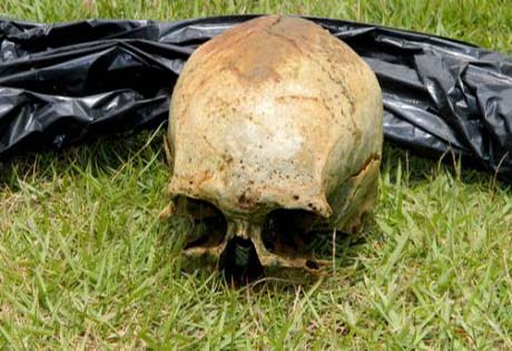 Crânio humano é achado no lago municipal de Arapiraca