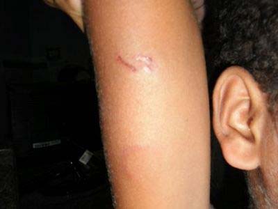 Pai é acusado de agredir filho com fio de telefone