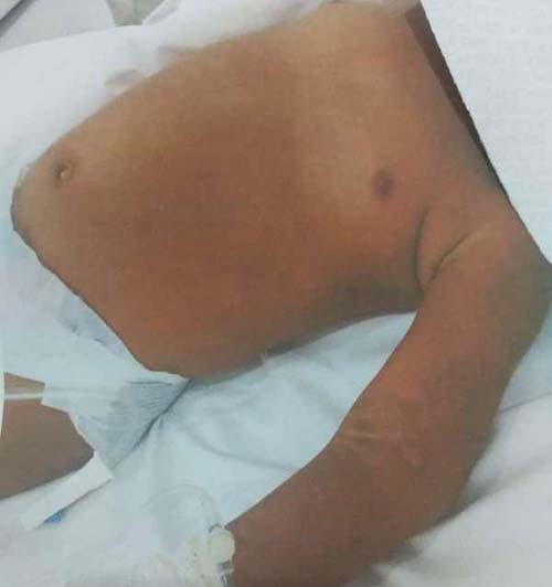 Casal é preso acusado de espancar duas crianças em Penedo