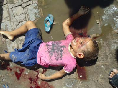 Criança de 4 anos tem o crânio esmagado por caçamba em Piaçabuçu 