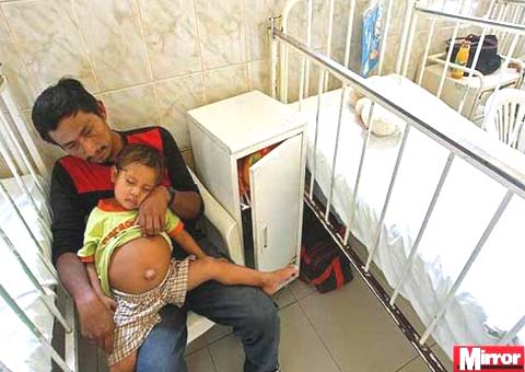 Médicos do Peru descobrem feto de 25 cm no abdômen de menino de três anos 