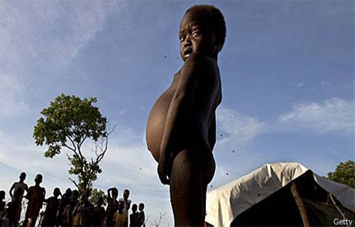 Uma criança morre de fome a cada dez segundos?