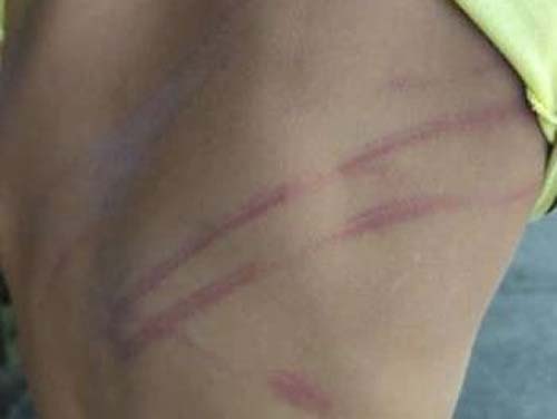 Mulher é presa acusada de espancar a filha de 8 anos usando fio de eletricidade