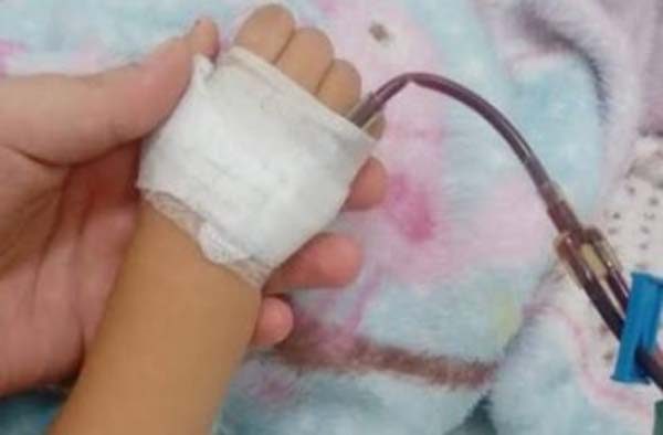 Criança de 4 anos ferida por pitbull é internada no Hospital de Emergência do Agreste