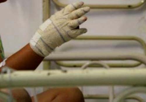 Criança morre após se queimar com café em acidente doméstico