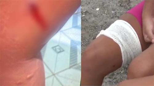 Veja versão da PM sobre ação que deixou crianças feridas no Vergel: 