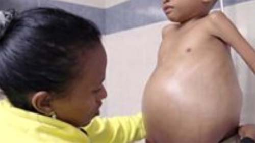 Crise na Venezuela: o drama das pessoas sem comida, remédios e eletricidade