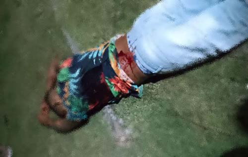 Jovem é morto a tiros no Residencial Recanto da Ilha em Marechal Deodoro