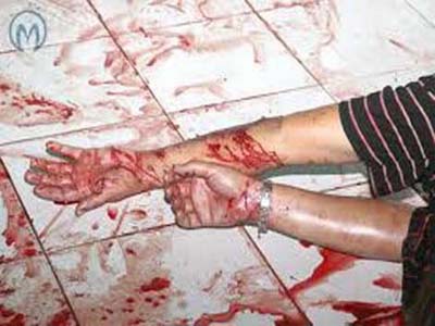 Com metralhadora, motoqueiros ferem 11 em festa; filho morre ao lado do pai 