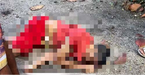 Homem com bolsa de colostomia é executado a tiros em Maceió
