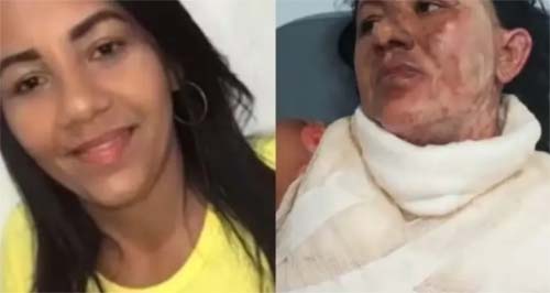 Morre mulher que teve 70% do corpo queimado pelo marido no bairro Antares